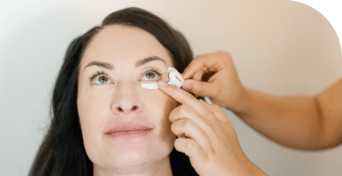 TearCare treatment image from Sight Sciences